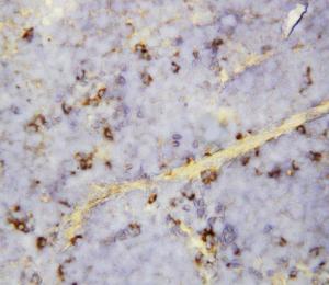 Anti-CXCL16 Rabbit Polyclonal Antibody