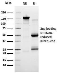 SDS-PAGE analysis of Anti-SERBP1 Antibody [SERBP1/3491] under non-reduced and reduced conditions; showing intact IgG and intact heavy and light chains, respectively. SDS-PAGE analysis confirms the integrity and purity of the antibody