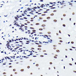 Immunohistochemistry analysis of paraffin-embedded human esophageal using Anti-TDP43 Antibody [ARC0492] (A306079) at a dilution of 1:100 (40x lens). Perform microwave antigen retrieval with 10 mM PBS buffer pH 7.2 before commencing with IHC staining protocol.