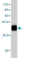 Anti-PEAK1 Mouse Monoclonal Antibody [clone: 1G9]