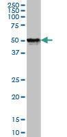 Anti-FOXA1 Mouse monoclonal antibody [clone: 4F6]