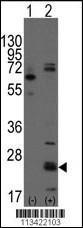 Anti-CD9 Rabbit Polyclonal Antibody (APC (Allophycocyanin))