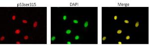 Anti-p53 (phospho Ser315) Antibody