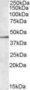 Anti-SIGLEC8 antibody