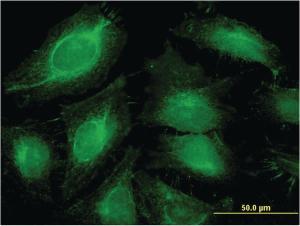 Anti-ABCF1 Mouse Monoclonal Antibody [clone: 1B4]