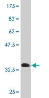 Anti-SCGB1A1 Mouse Monoclonal Antibody [clone: 1F7]