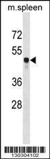 Anti-CSK Rabbit Polyclonal Antibody (HRP (Horseradish Peroxidase))