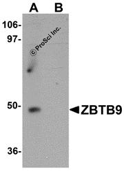 Western blot analysis of ZBTB9 in mouse heart tissue lysate with ZBTB9 antibody at 1 &#956;g/mL in (A) the absence and (B) the presence of blocking peptide.