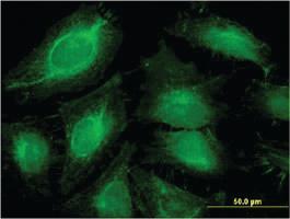 Anti-ABCF1 Mouse Monoclonal Antibody [clone: 1B4]