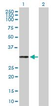 Anti-PRTN3 Mouse Polyclonal Antibody