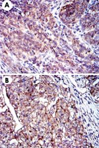 Anti-CD9 Mouse Monoclonal Antibody [clone: 5G6]