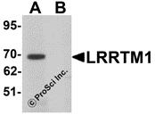 Western blot analysis of LRRTM1 in mouse brain tissue lysate with LRRTM1 antibody at 1 &#956;g/mL in (A) the absence and (B) the presence of blocking peptide.