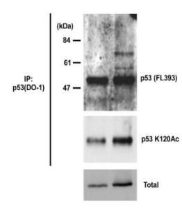 Anti-p53 (acetyl K120) Antibody