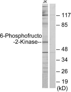 Western blot analysis of lysates from Jurkat cells using Anti-PFKFB2 Antibody. The right hand lane represents a negative control, where the antibody is blocked by the immunising peptide