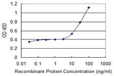 Anti-ABCF1 Mouse Monoclonal Antibody [clone: 1B4]