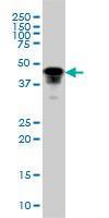 Anti-FOXA1 Mouse monoclonal antibody [clone: 2D7]