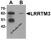 Western blot analysis of LRRTM3 in mouse brain tissue lysate with LRRTM3 antibody at 0.5 &#956;g/mL in (A) the absence and (B) the presence of blocking peptide.