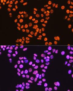 Immunofluorescence analysis of HeLa cells using Anti-TDP43 Antibody [ARC0492] (A306079) at a dilution of 1:100 (40x lens). DAPI was used to stain the cell nuclei (blue).