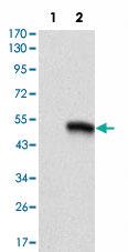 Anti-CD9 Mouse Monoclonal Antibody [clone: 5G6]