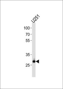 Anti-CNOT8 Rabbit Polyclonal Antibody (AP (Alkaline Phosphatase))