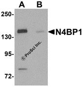 Western blot analysis of N4BP1 in HeLa cell lysate with N4BP1 antibody at 0.5 &#956;g/mL in (A) the absence and (B) the presence of blocking peptide.