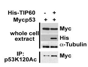 Anti-p53 (acetyl K120) Antibody