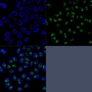 Immunofluorescent analysis of HeLa cells stained with Anti-Nucleolin Antibody [SPM614] (CF and #174; 647R) (Green). Nuclei are counter stained with DAPI (Blue)