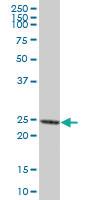 Anti-PRTN3 Mouse Polyclonal Antibody