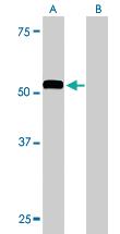 Anti-DCDC2 Goat Polyclonal Antibody