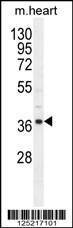 Anti-NDUF3 Rabbit Polyclonal Antibody (HRP (Horseradish Peroxidase))