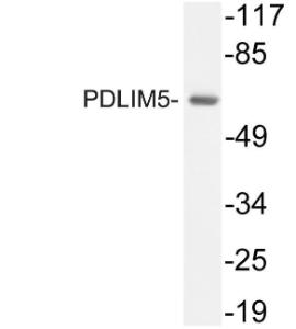 Western blot analysis of lysate from A549 cells using Anti-PDLIM5 Antibody