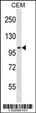 Anti-LIG3 Rabbit Polyclonal Antibody (AP (Alkaline Phosphatase))