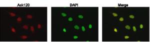 Anti-p53 (acetyl K120) Antibody