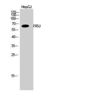 Western blot analysis of HepG2 cells using Anti-FRS2 Antibody