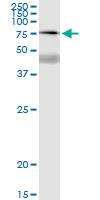 Anti-SSX2 Polyclonal Antibody Pair