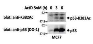 Anti-p53 (acetyl K382) Antibody