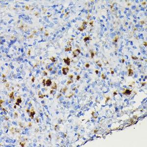 Anti-CCR3 Rabbit Polyclonal Antibody