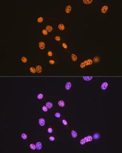 Immunofluorescence analysis of NIH-3T3 cells using Anti-TDP43 Antibody [ARC0492] (A306079) at a dilution of 1:100 (40x lens). DAPI was used to stain the cell nuclei (blue).