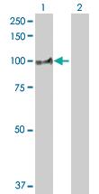 Anti-AOC1 Rabbit Polyclonal Antibody