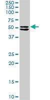 Anti-TRIM16 Rabbit Polyclonal Antibody