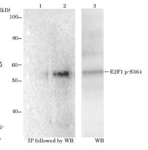 Anti-E2F1 (phospho Ser364) Antibody