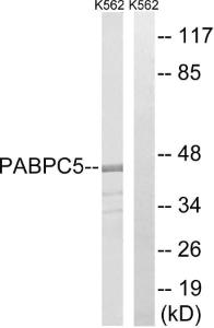 Western blot analysis of lysates from K562 cells using Anti-PABPC5 Antibody. The right hand lane represents a negative control, where the antibody is blocked by the immunising peptide.