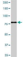 Anti-AOC1 Rabbit Polyclonal Antibody