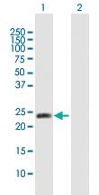 Anti-NTMT1 Mouse Polyclonal Antibody