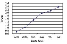 Anti-SHMT1 Antibody Pair