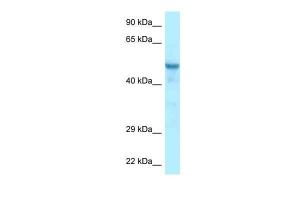 Anti-CCDC6 Rabbit Polyclonal Antibody