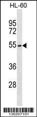 Anti-MGAT3 Rabbit Polyclonal Antibody (APC (Allophycocyanin))