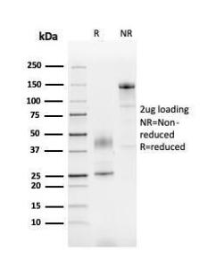 SDS-PAGE analysis of Anti-SERBP1 Antibody [SERBP1/3492] under non-reduced and reduced conditions; showing intact IgG and intact heavy and light chains, respectively. SDS-PAGE analysis confirms the integrity and purity of the antibody