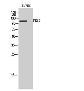 Western blot analysis of HUVEC cells using Anti-FRS2 Antibody