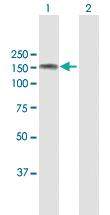 Anti-ABL2 Mouse Polyclonal Antibody